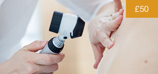 Dermoscopy in the Assessment of Pigmented Lesions in Podiatry